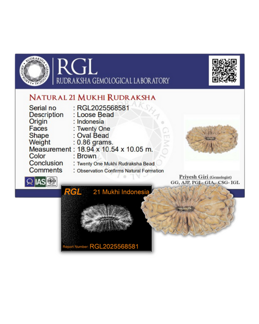 xray report of 21mukhi by shivaratna